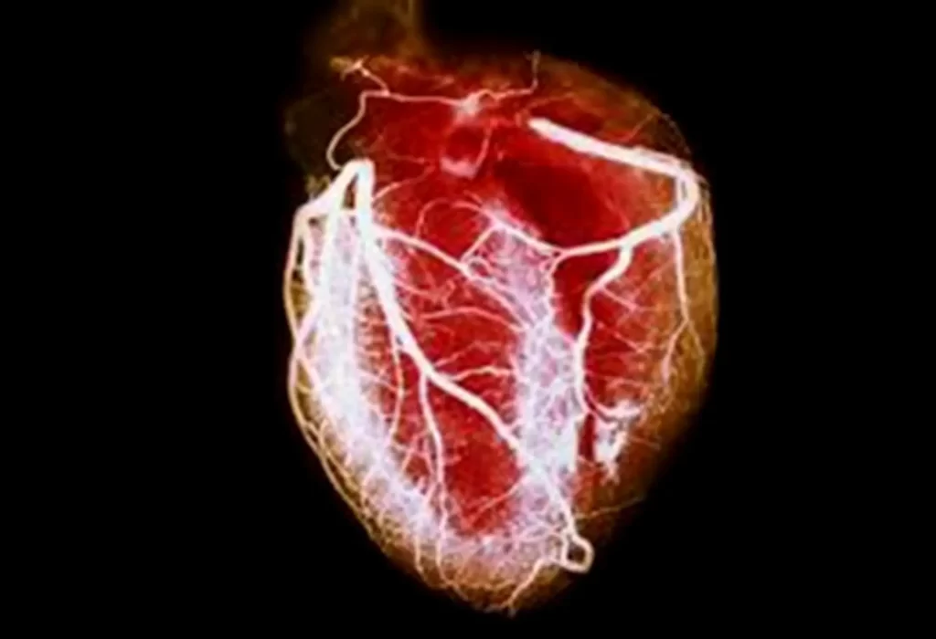 Do patients with Coronary Artery Disease really need that STENT?